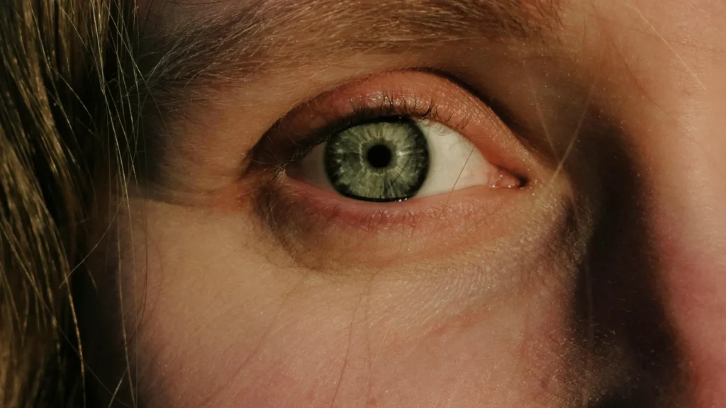 Eye Cataract Causes: What Leads to Cataracts and When Surgery Becomes the Answer